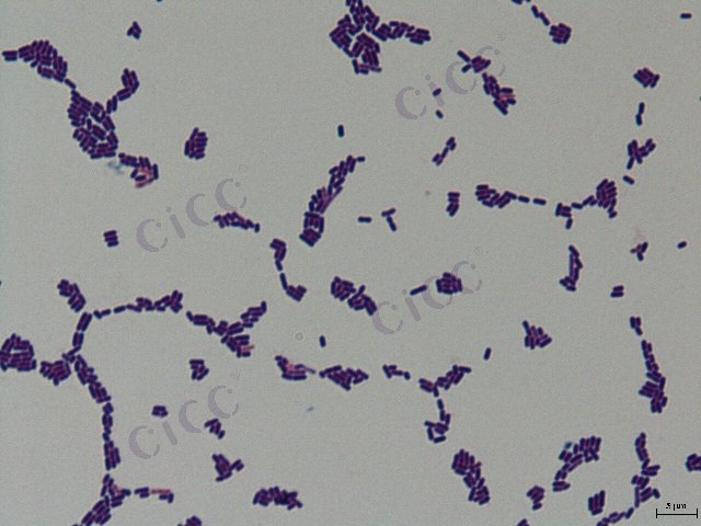 Lactiplantibacillus plantarum