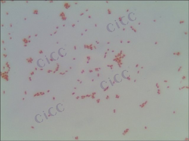 Salmonella enterica subsp enterica serotype Bonariensis