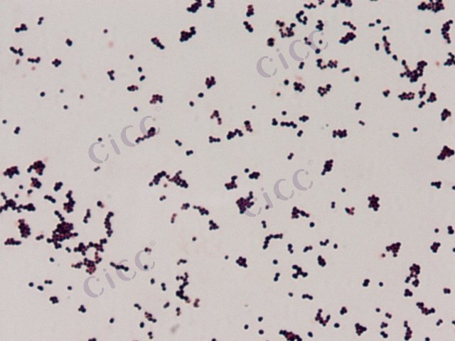 Brachybacterium sp
