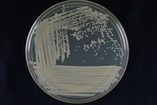 Acinetobacter baumannii