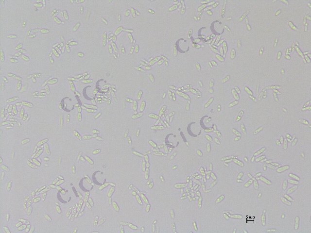 Sympodiomycopsis kandeliae