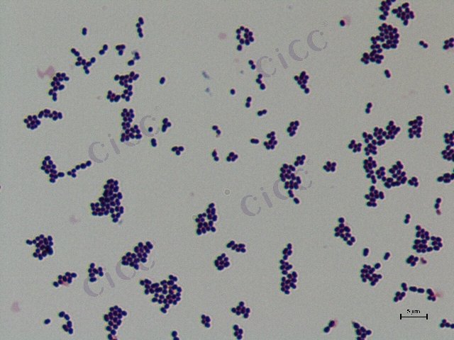 Enterococcus faecium