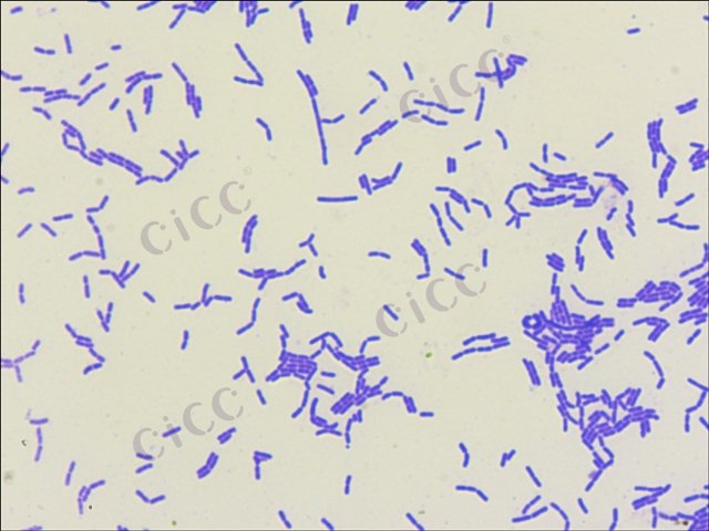 Lacticaseibacillus paracasei subsp tolerans
