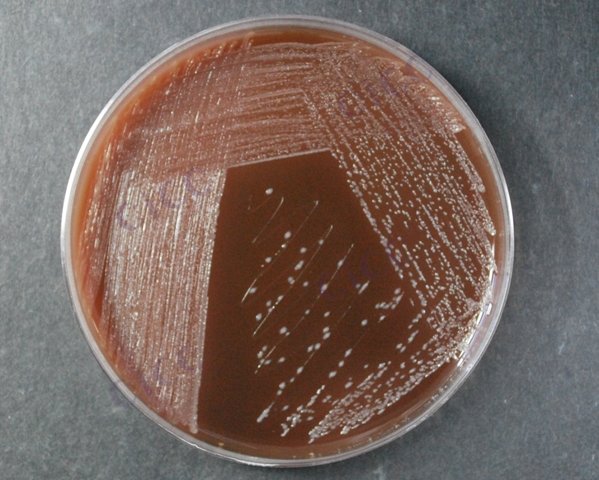 丁酸梭菌 Clostridium butyricum CICC 10390 Clostridium butyricum