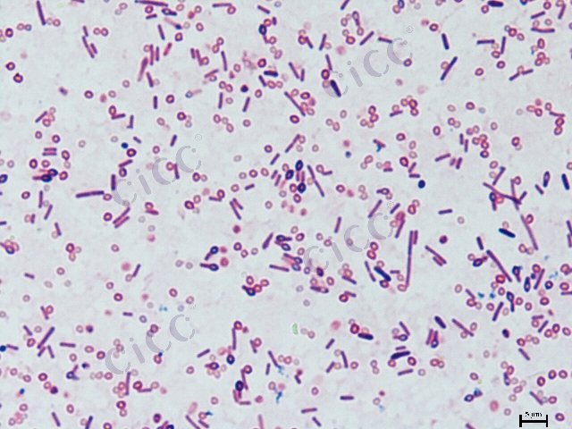 Bacillus sphaericus