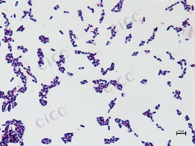 Lysinibacillus sp