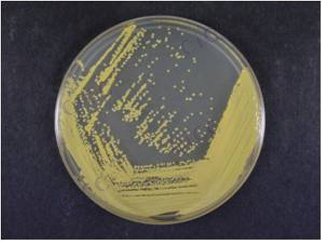 Micrococcus sp