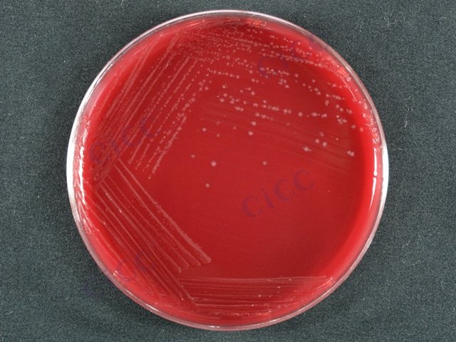 Clostridioides difficile