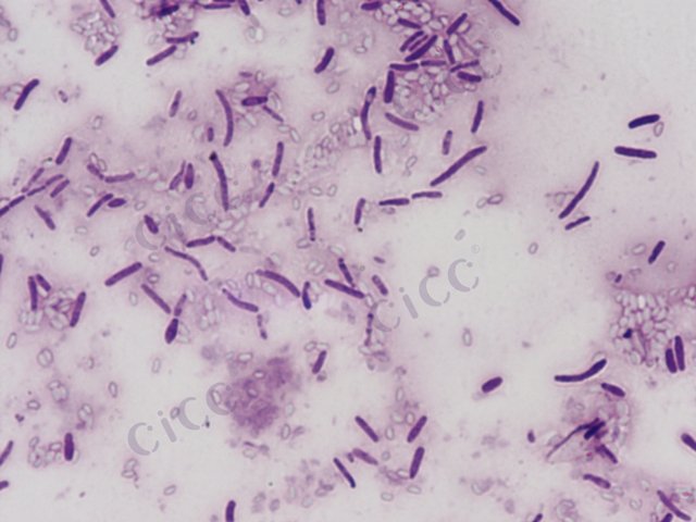 Anoxybacillus rupiensis