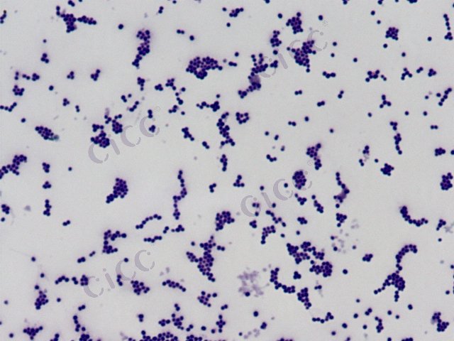 Staphylococcus warneri