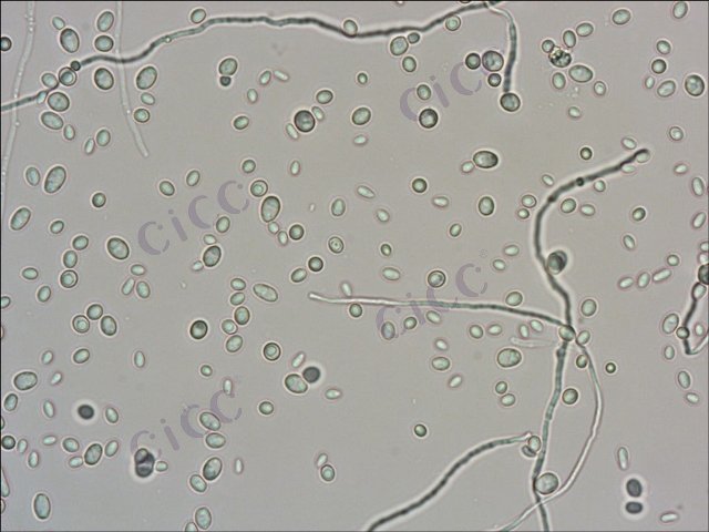 Candida tropicalis