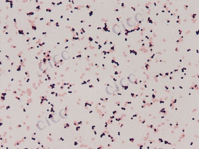 Brachybacterium zhongshanense