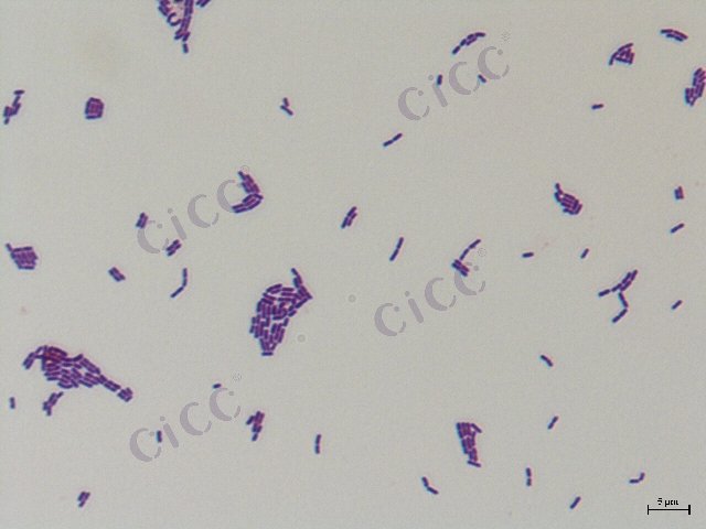 Lacticaseibacillus rhamnosus