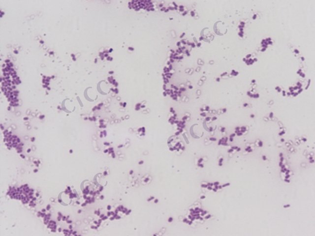 Salmonella enterica subsp enterica serotype Wandsworth