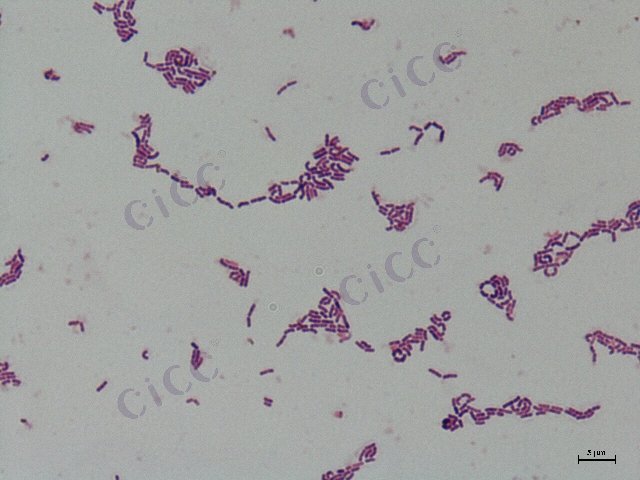Lacticaseibacillus paracasei subsp paracasei