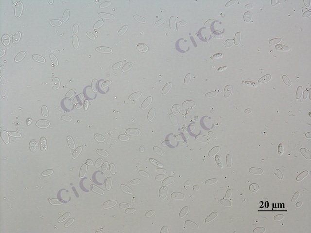 Saccharomyces cerevisiae