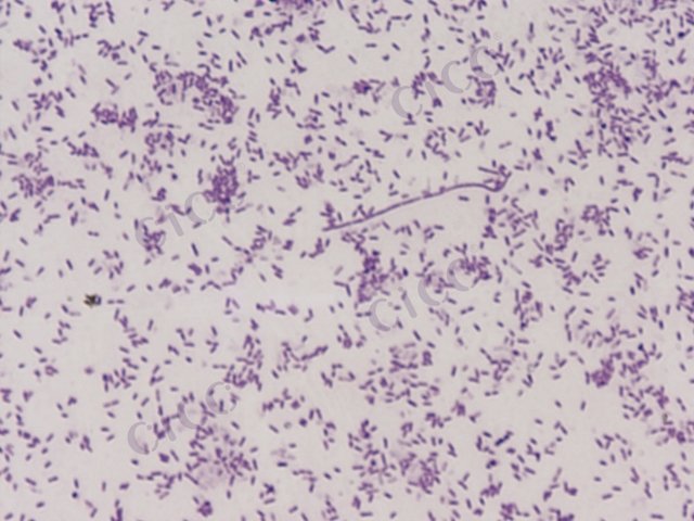 Flavobacterium tibetense