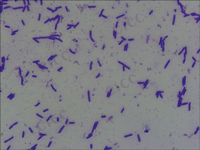 解淀粉芽胞杆菌 Bacillus amyloliquefaciens CICC 10081 Bacillus amyloliquefaciens