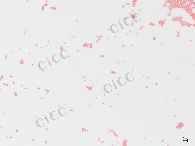 Enterobacter cloacae
