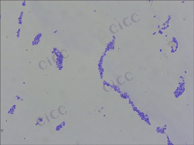 Salmonella enterica subsp enterica serovar Thompson