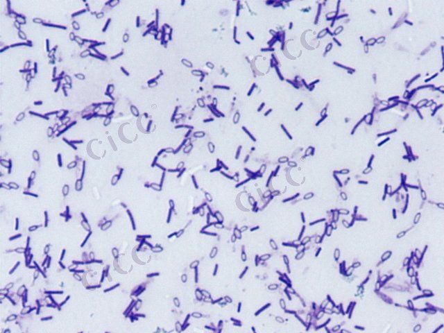 嗜热脂肪地芽胞杆菌 Geobacillus stearothermophilus CICC 10425 Geobacillus stearothermophilus