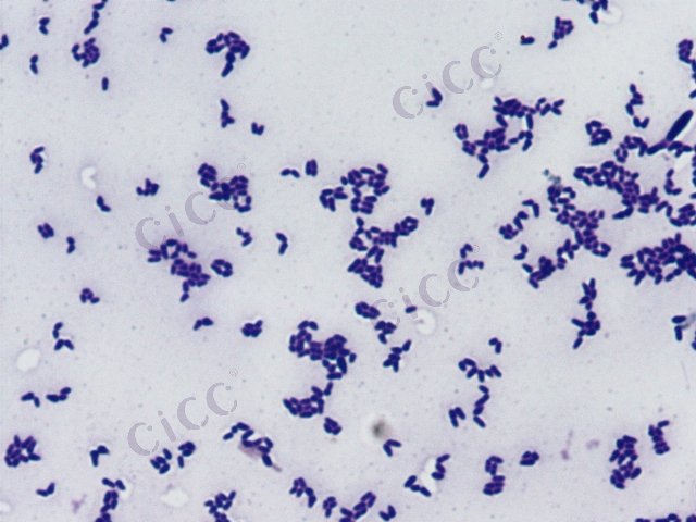 Corynebacterium callunae