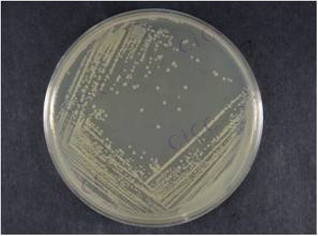 解木糖赖氨酸芽胞杆菌 Lysinibacillus xylanilyticus CICC 10601 Lysinibacillus xylanilyticus