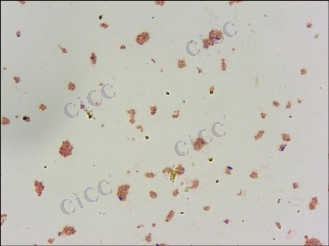 Flavobacterium sp