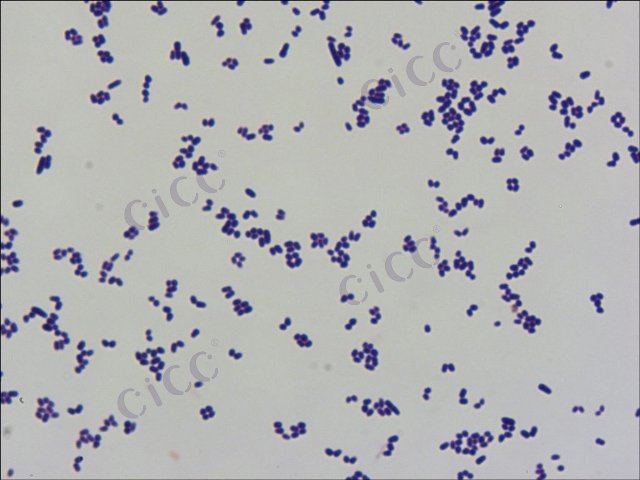 Arthrobacter sp