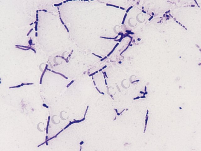 Streptomyces microflavus