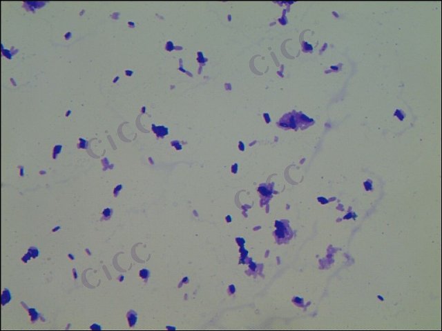 Corynebacterium ammoniagenes