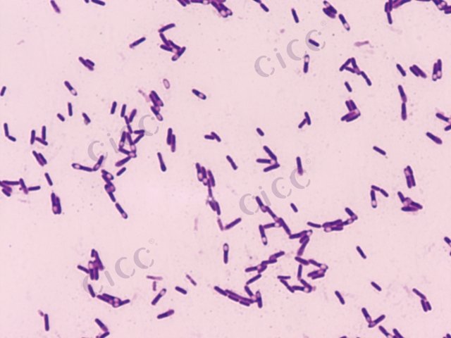 生孢梭菌 Clostridium sporogenes CICC 10409 Clostridium sporogenes