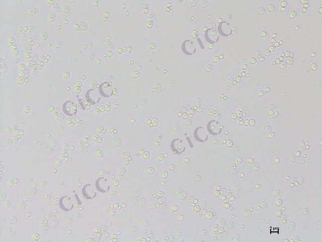 Tetrapisispora iriomotensis