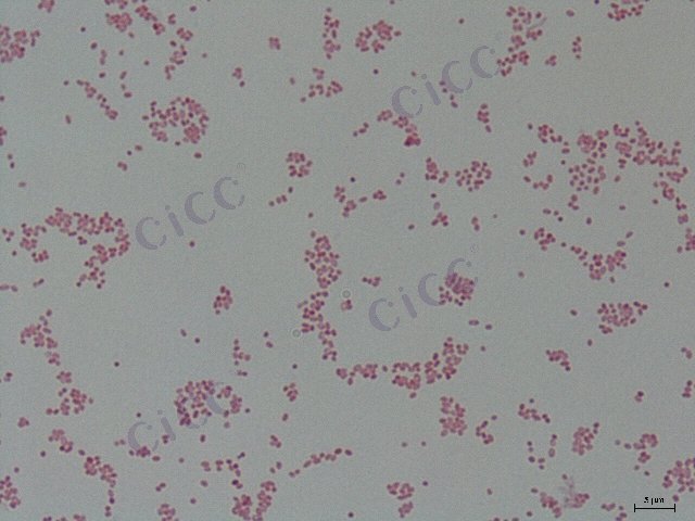 Vibrio parahaemolyticus