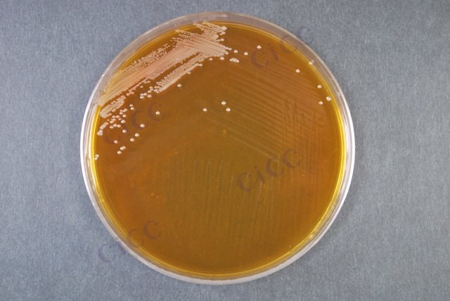 Acetobacter pasteurianus