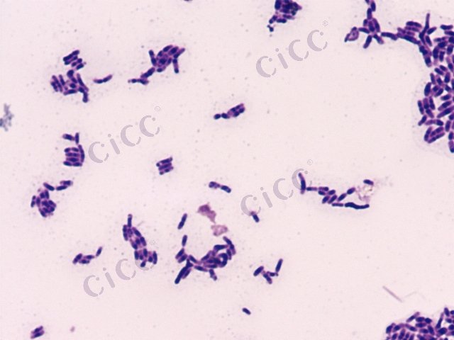 Ligilactobacillus salivarius