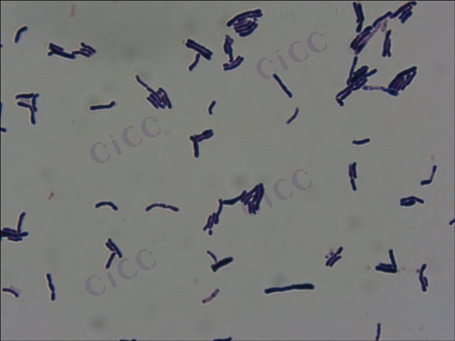 Bifidobacterium animalis