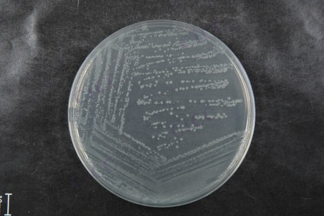 大肠埃希氏菌 Escherichia coli CICC 10302 Escherichia coli