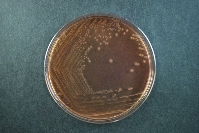 宋内氏志贺氏菌 Shigella sonnei CICC 21535 Shigella sonnei