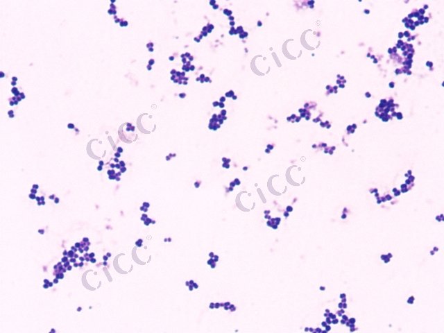 Staphylococcus capitis