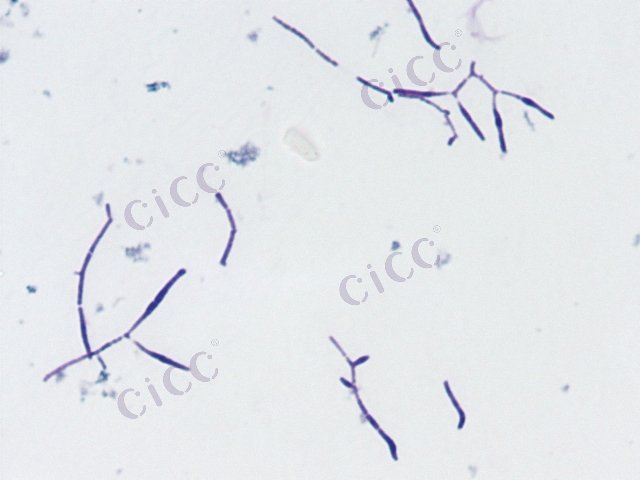 Streptomyces olivaceus