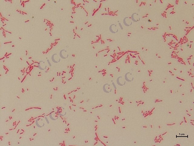 Alcaligenes faecalis