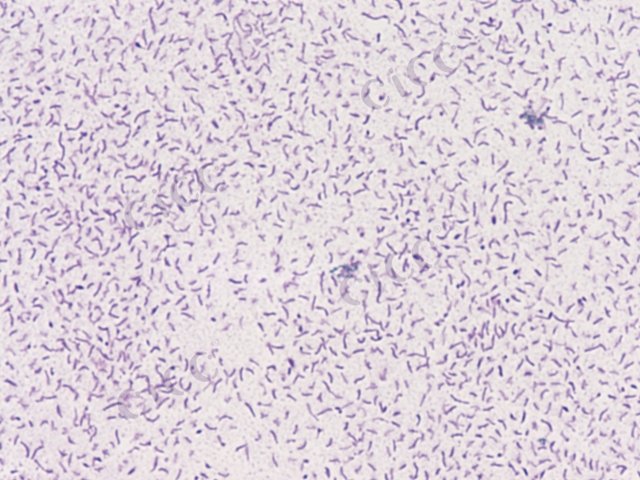 Psychrosphaera aquimarina