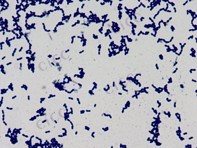 Weissella paramesenteroides