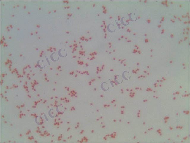 Salmonella enterica subsp enterica serotype Wandsworth