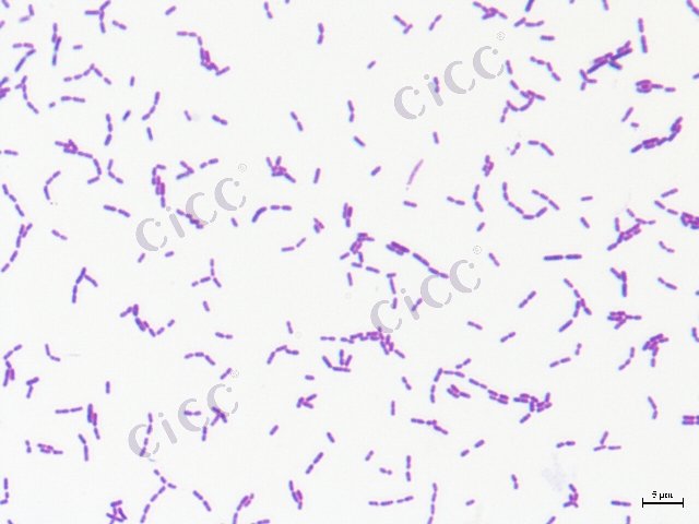 Lacticaseibacillus paracasei subsp paracasei