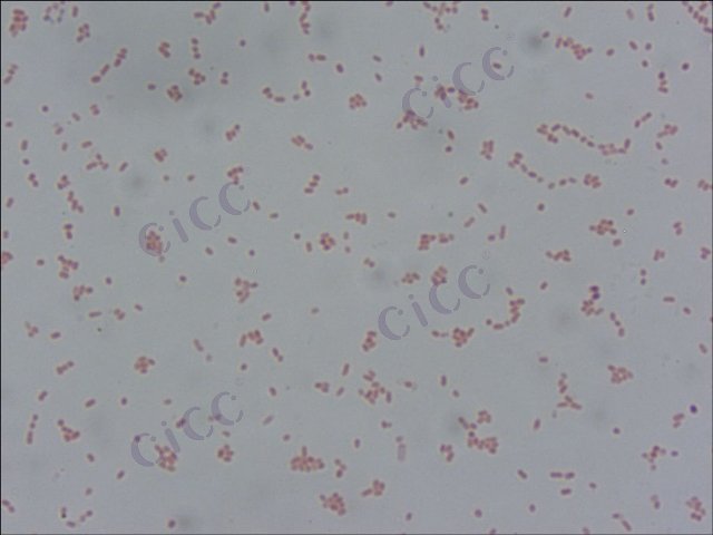 肠沙门氏菌肠亚种肠炎血清型 Salmonella enterica subsp enterica serovar Enteritidis CICC 21513 Salmonella enterica subsp enterica serovar Enteritidis