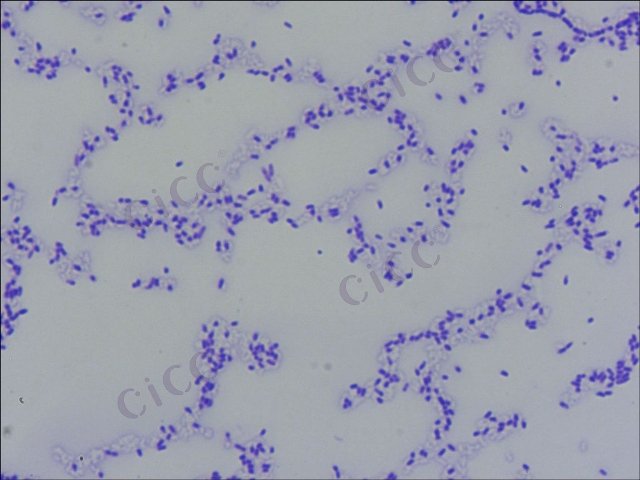 Achromobacter sp