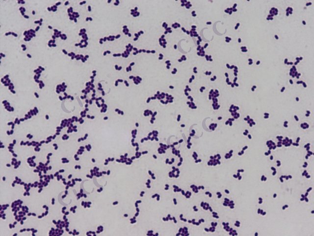 Enterococcus faecalis