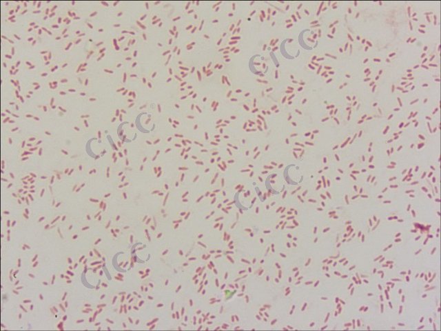 Novosphingobium lindaniclasticum